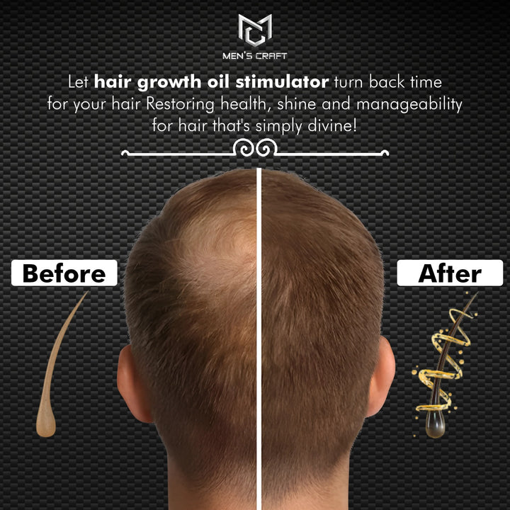 Men's Craft Hair Growth Oil