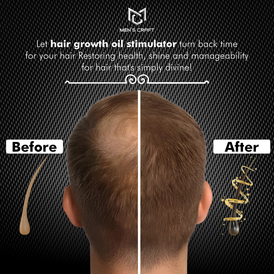 Men's Craft Hair Growth Oil - Stimulator